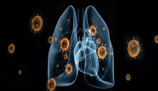 面对来势汹汹的新型肺炎，我们该怎么预防？